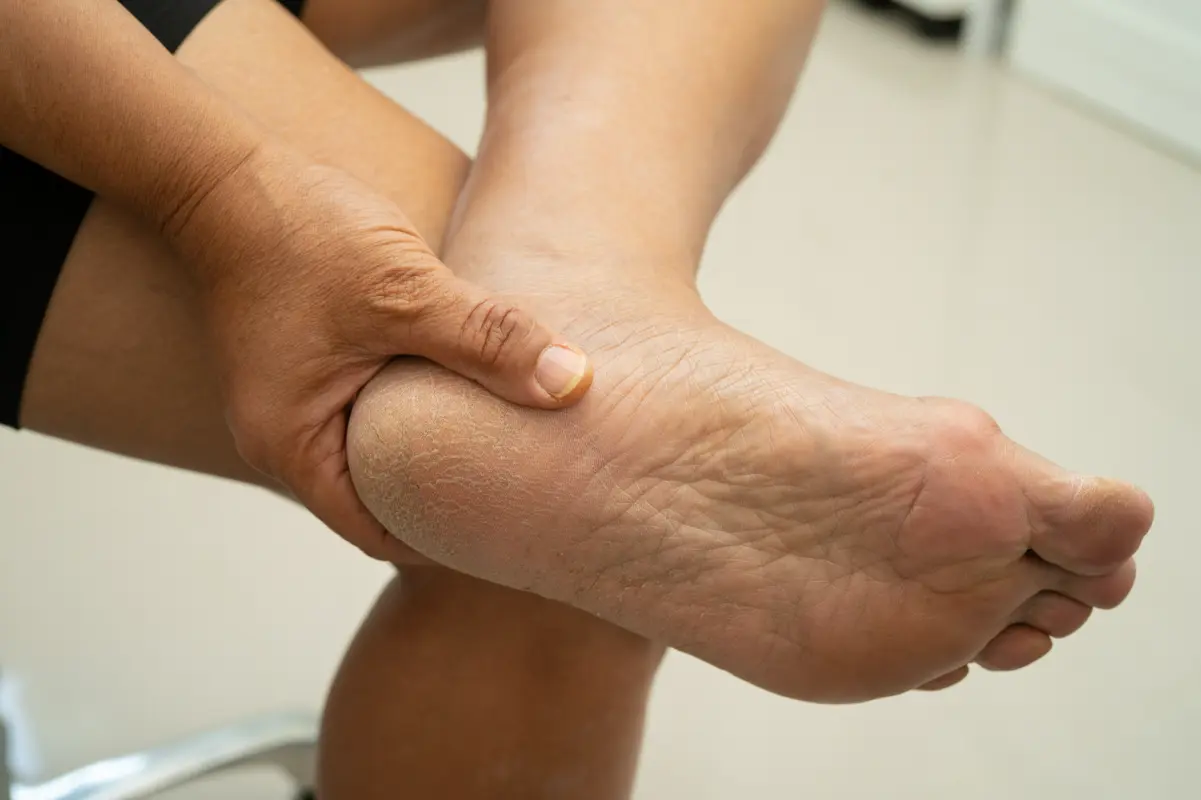 Heel Pain 2
