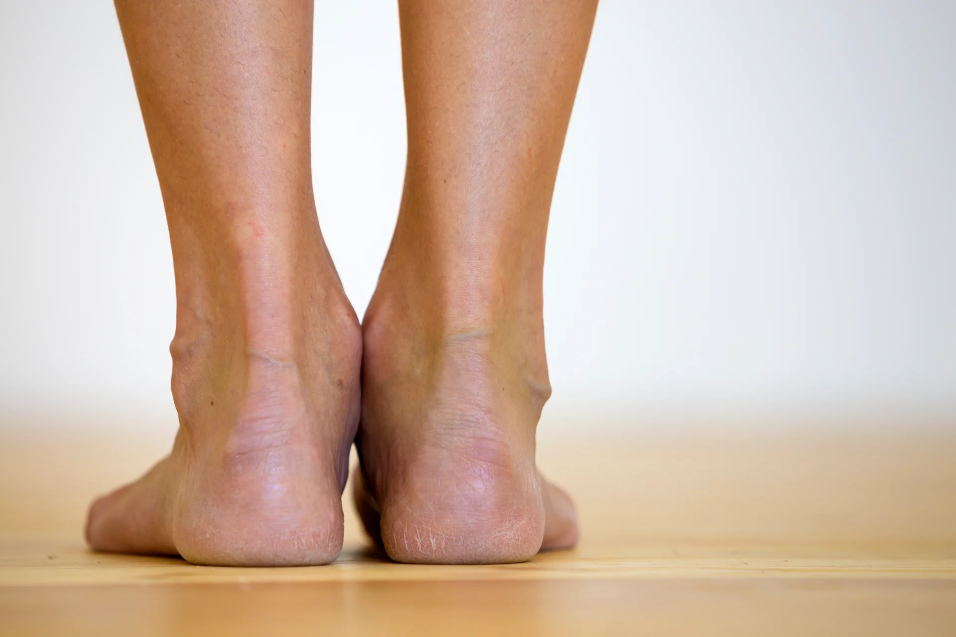 cracked heel skin problems and foot care 2026 03 16 00 39 42 utc 1