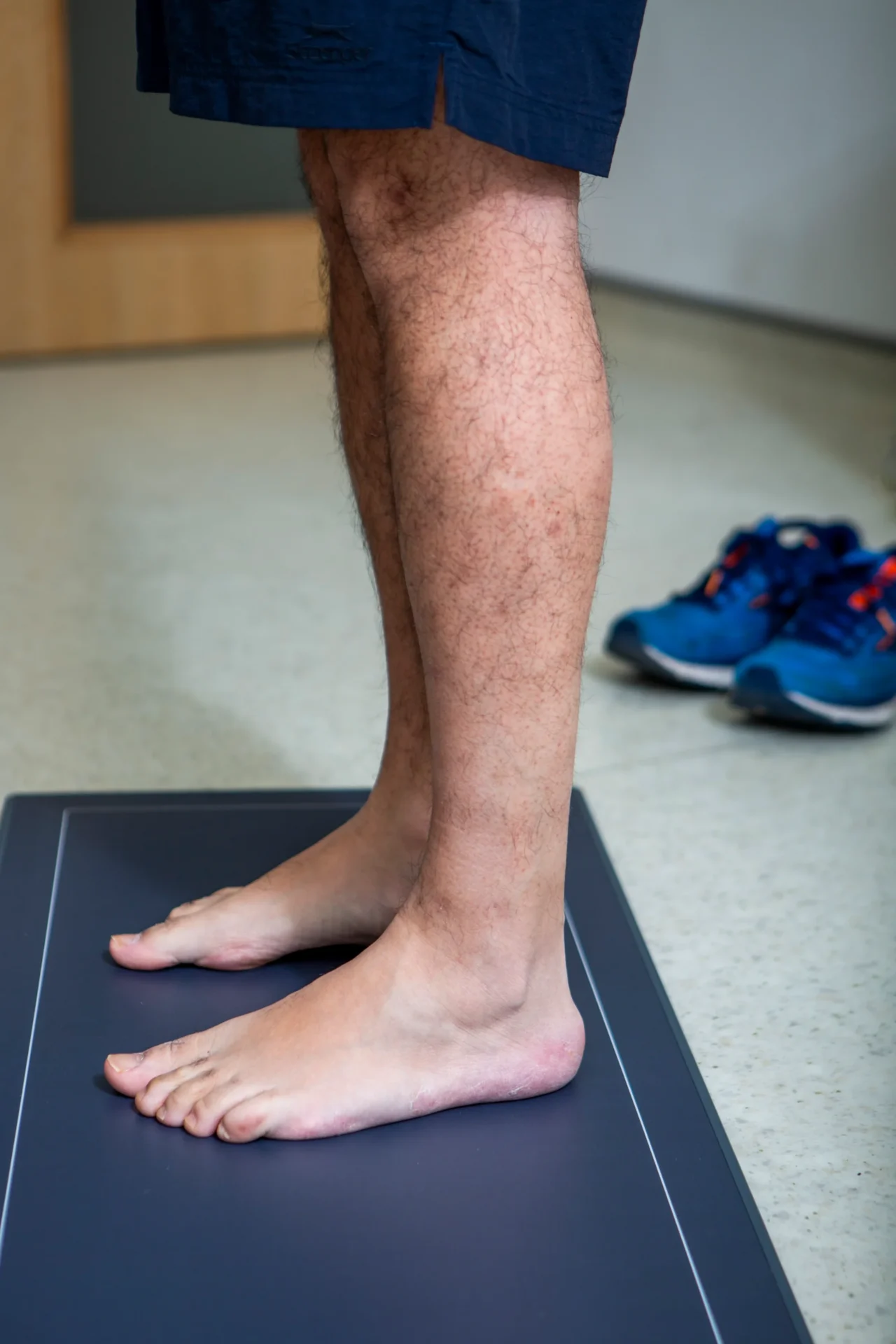 Foot Scan Assessment